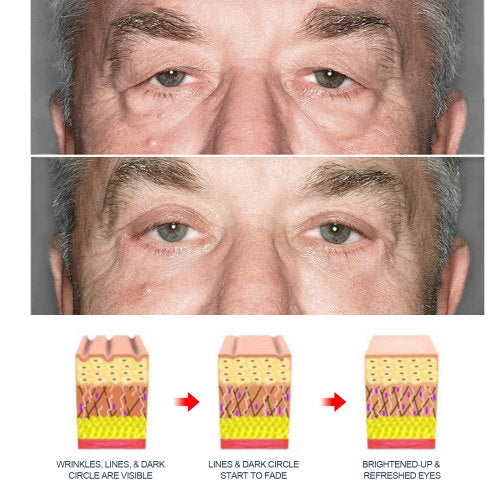 Retinol øjencreme til mænd