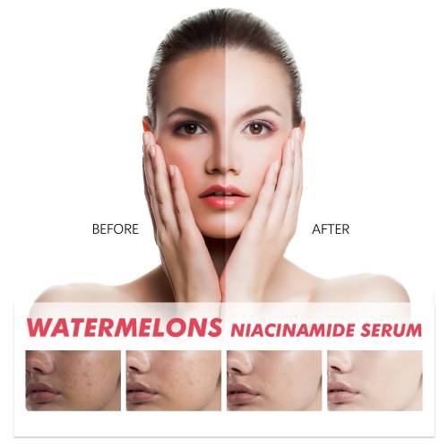 Vandmelon niacinamid serum