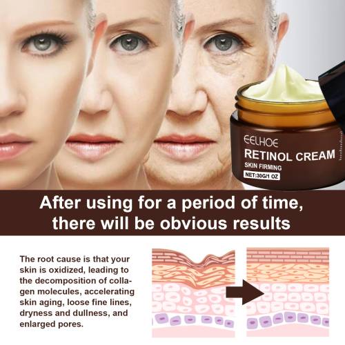 Retinol ansigtscreme, opstrammende og strålende