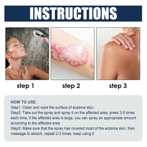 Gurkemeje aloe hudspray