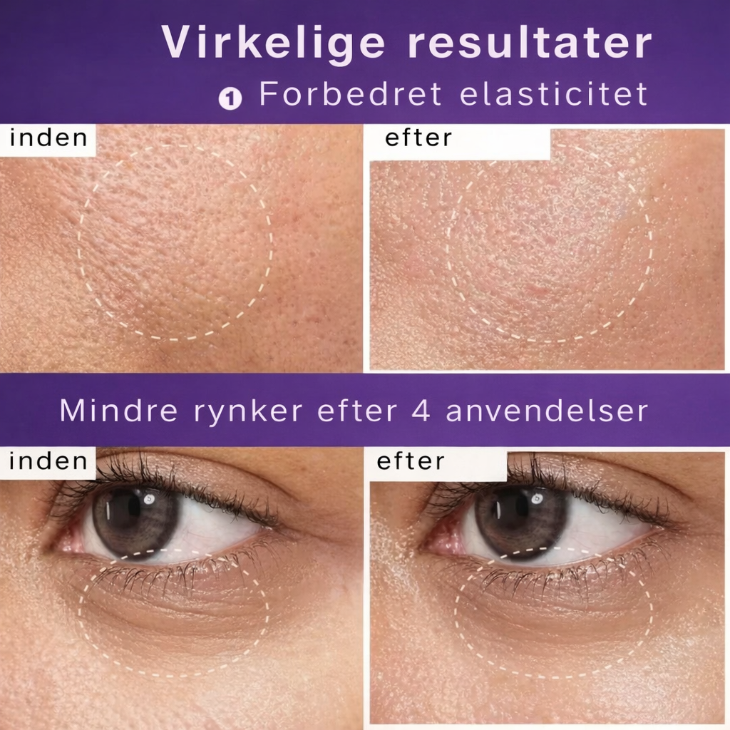 HudPretty™ – NAD+ Løfteserum & Maske
