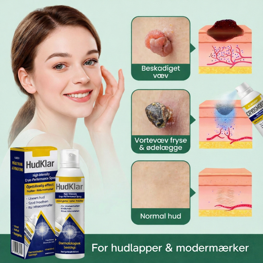 HudPretty™ ChillErase – Præcis kølende spray til glattere hud