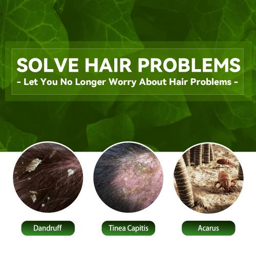 Urte hovedbundsshampoo med bynke og kaprifolie
